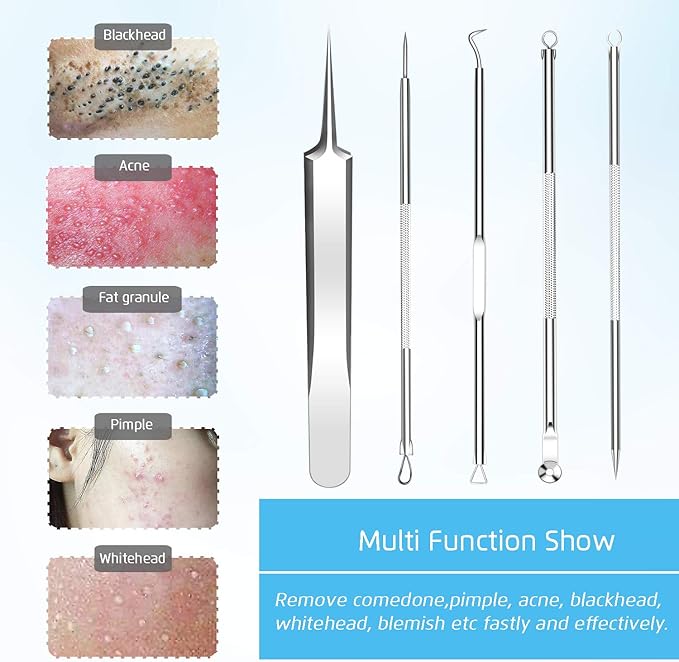Best Blackhead Remover, Blackheads Blemish Removing, Acne Whitehead Removal Kit, Pimple Comedone Extractor Tool, Popper Pimples Treatment, with Tweezers, Risk Free for Face Forehead Nose