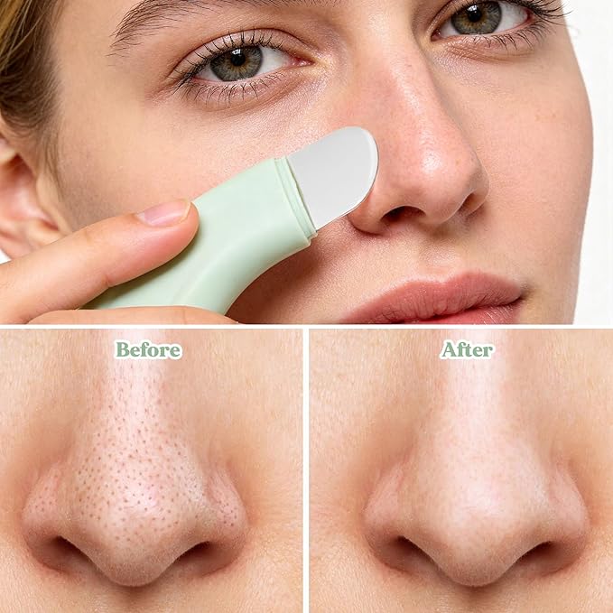 Skin Scrubber Face Spatula & Silicone Face Scrubber, Blackhead Remover Tool, Face Scrubber Skin Care Scraper Mask Applicator Spatula for Exfoliating, Massaging, Remove Blackheads, Pore Cleaning