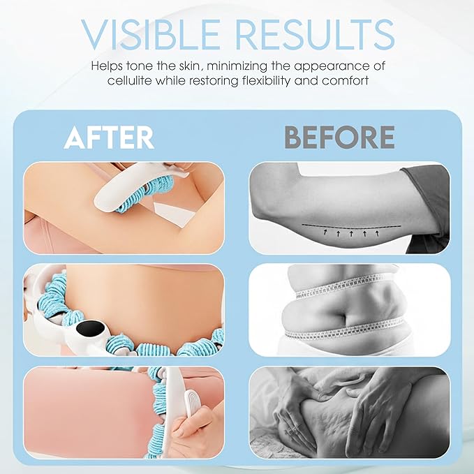 Cellulite Massage Roller, Fascia Blaster, Lymphatic Drainage Massager, Relieve Muscle Soreness, Body Sculpting Tool with Detachable Handles for Thighs, Legs, Buttocks, Gift Exfoliating Brush (Blue)