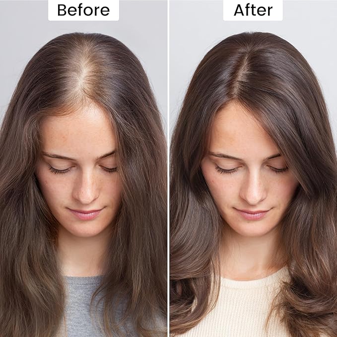 VOLLUCK Root Touch up Powder, Instant Hairline Powder for Thinning Areas and Gray Hair Coverage, Natural and Non-greasy Root Cover up for Women and Men (Medium Brown, 0.14 Ounce)