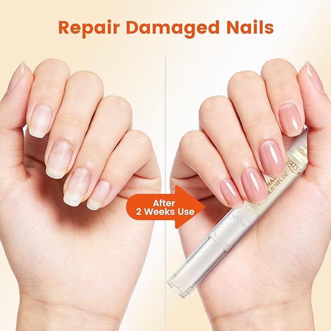 Honey Nail Oil Treatment for Growth & Strength, Cuticle Oil Pen to Deeply Nourish, Moisturize & Repair Dry, Brittle, Peeling & Damaged Nails, Mother's Day Gifts for Mom