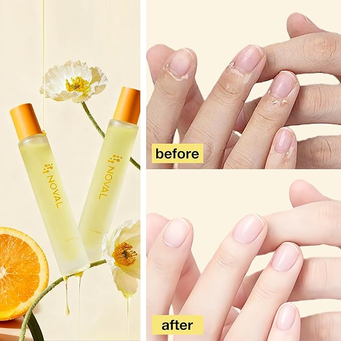 NOVAL Rollerball Cuticle Oil for Men & Women, Travel Size Bottle, Fresh Smell Citrus Scent, Essential Nail Care Serum, Rich in Jojoba Oil, Natural Ingredients