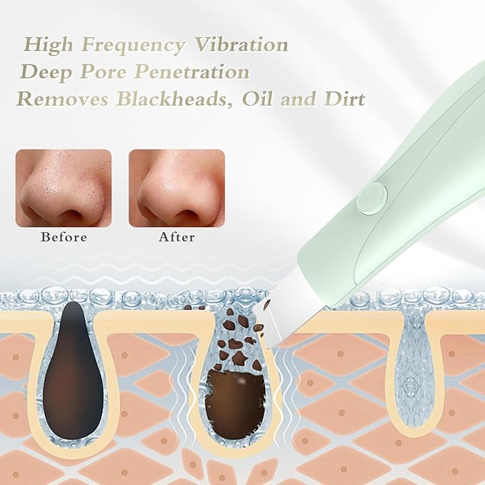 Dual-Mode Blackhead Remover Tools- Skin Scrubber Face Spatula | Battery/Handheld Face Scraper for Deep Cleansing, Skin Care Tool for Men and Women (Green)