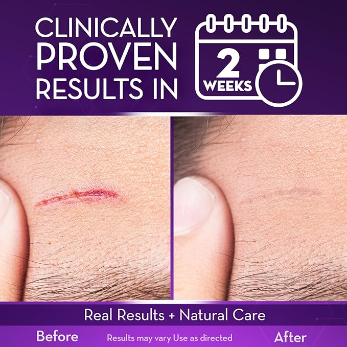 Cicatricure Advanced Scar Gel for Face & Body - Proven Results in 2 Weeks, Scar Treatment for Surgical Scars, Stretch Marks, Scars of Burns and Injuries, Acne Scar Treatment, 1 oz (28 g) - Pack of 2