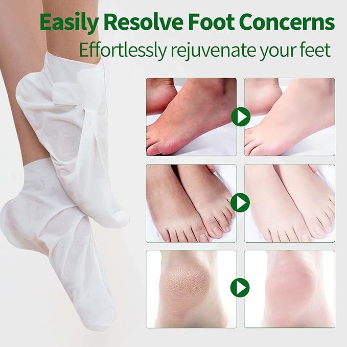 5 Pack Moisturizing Foot Mask,Hydrating Foot Masks for Dry Cracked Feet,Moisturizing Socks Dry Skin Moisturizer for Soft and Smooth Touch Feet,Foot Care Spa Gifts for Women Men Easter Basket Stuffers