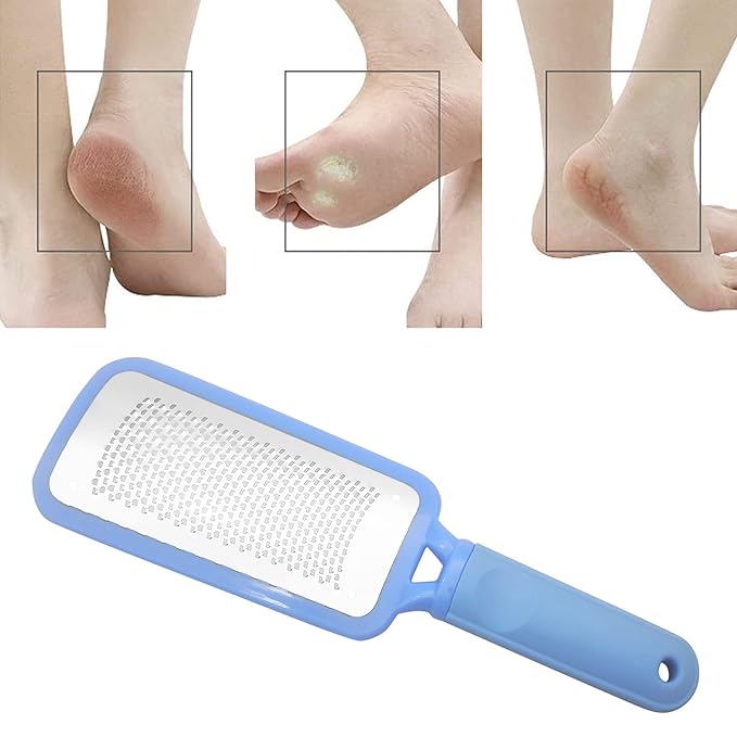 Professional Foot Files Callus Remover,Foot Scrubber for Dead Skin,Stainless Steel Foot Rasp-Blue（1 Pack）
