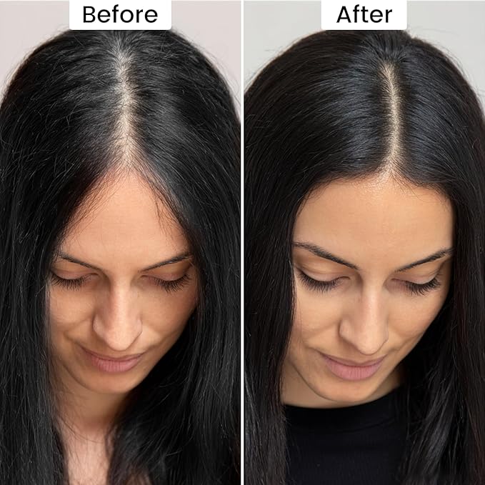 VOLLUCK Root Touch up Powder, Instant Hairline Powder for Thinning Areas and Gray Hair Coverage, Natural and Non-greasy Root Cover up for Women and Men (Dark Black, 0.14 Ounce)