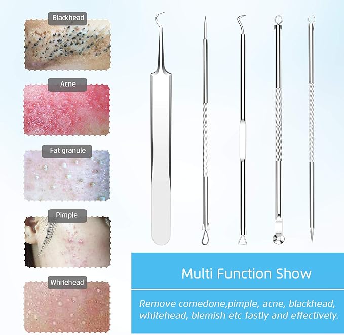 Premium Blackhead Remover, Comedone Blemish Acne Extractor,Popping Pimple Popper Whitehead Removal, Precision Tweezers, Zit Removing, Milia Remove