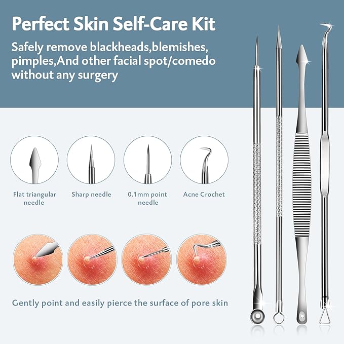MENOLY Pimple Popper Tool Kit 10 Pcs Blackhead Remover Tool Zit Popper for Blemish, Pimple Comedone Extractor Acne Tool for Blackheads, Acnes, Whiteheads Nose Face with Leather Bag