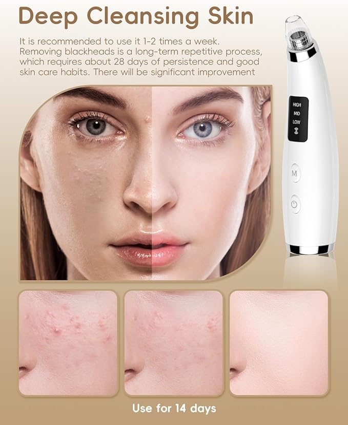 Rechargeable Blackhead Vacuum Pore Cleaner - 5 Attachments & 3 Suction Levels for Deep Facial Cleansing, USB-Powered Blackhead Remover for Women and Men (White)