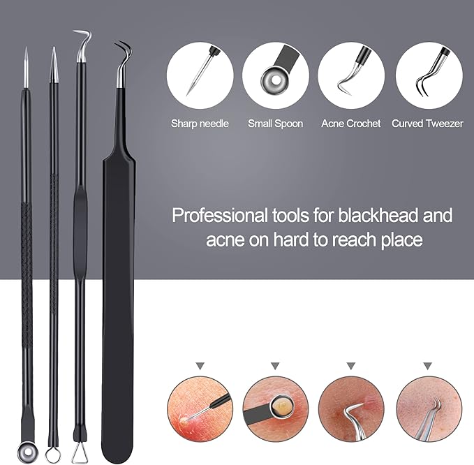MENOLY Pimple Popper Tool Kit 10 Pcs Blackhead Remover Tool Zit Popper for Blemish, Pimple Comedone Extractor Acne Tool for Blackheads, Acnes, Whiteheads Nose Face Tools with Leather Bag