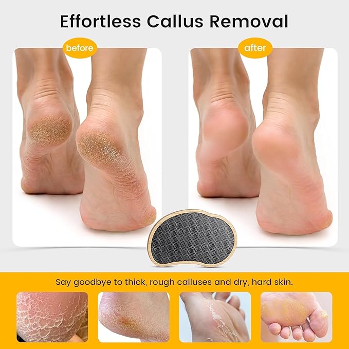 BEZOX Nano-Glass Pumice Stone for Feet Dead Skin, Eco-Friendly Pedicure Foot File Callus Remover - Bamboo Handle