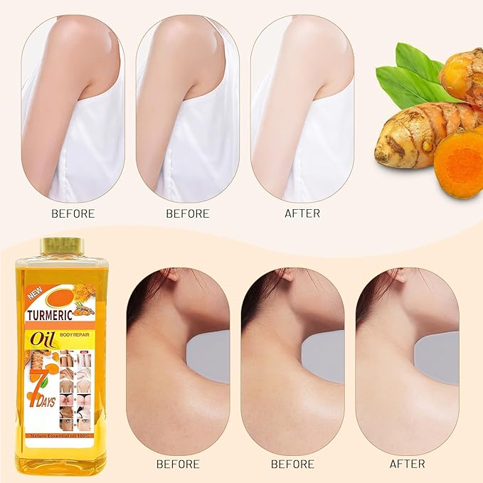 Soft 7 oil, Soft 7 Turmeric Oil, Soft 7 Turmeric oil for skin, Natural Moisturizing Nourishing for Face and Body Oil For All Skin Types