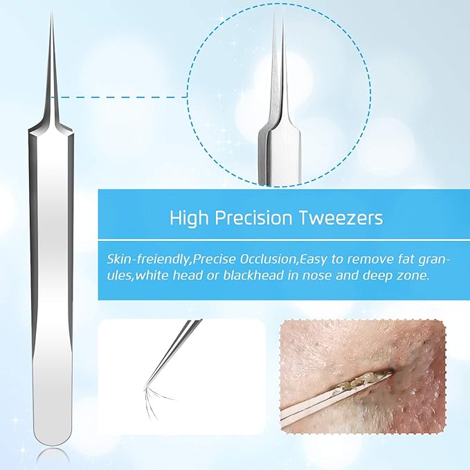 Best Blackhead Remover, Blackheads Blemish Removing, Acne Whitehead Removal Kit, Pimple Comedone Extractor Tool, Popper Pimples Treatment, with Tweezers, Risk Free for Face Forehead Nose