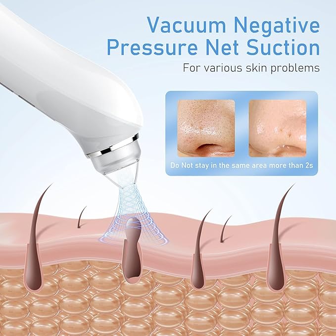 Blackhead Remover Vacuum, USB Interface Type Pore Vacuum, Black Head Extractions Tool with Camera for Men and Women Pore Cleaner, 3 Adjustment Modes & 6 Suction Heads(Blue)