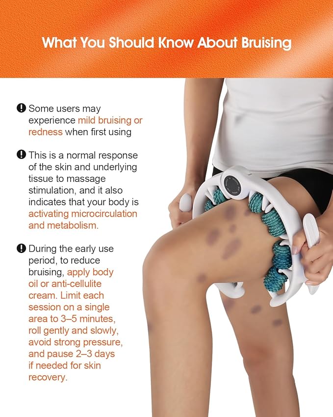 Anti Cellulite Massage Tool - Ergonomic Cellulite Remover for Legs and Arms with Detachable Handles - Smooth-Glide Lymphatic Drainage Massager for Boost Confidence and Tightened Skin(Green)