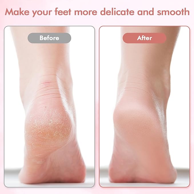 Electric Foot File and Callus Remover,Professional Pedicure Tools for Dry, Calluses, Dead, Cracked, Hard Skin,Equipped with 2 Grinding Heads and 1 Cleaning Brush