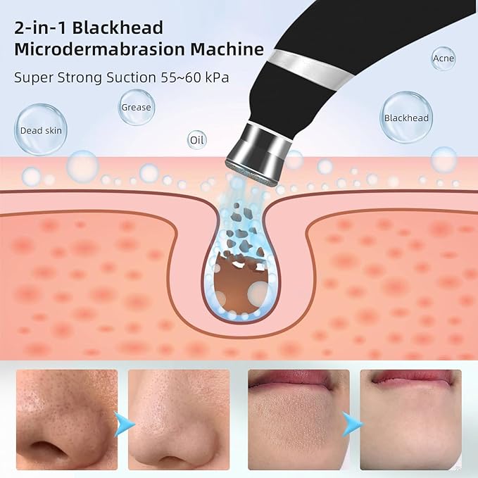IeBilif Diamond Microdermabrasion Machine, 3 Modes Diamond Microdermabrasion Dermabrasion Machine for Blackhead Removal, Portable Microdermabrasion Tool with 8 Diamond Tips