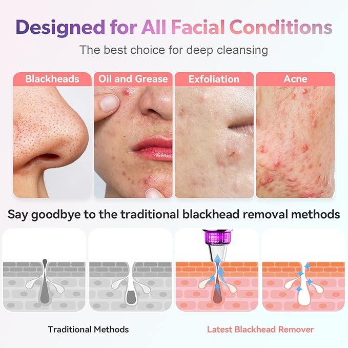 Blackhead Remover Pore Vacuum, Blackhead Vacuum, Facial Pore Cleaner with 5 Adjustable Suction Levels, 5 Probes, USB Rechargeable Pore Cleaner, Electric Comedone Whitehead Extractor Tools Kit