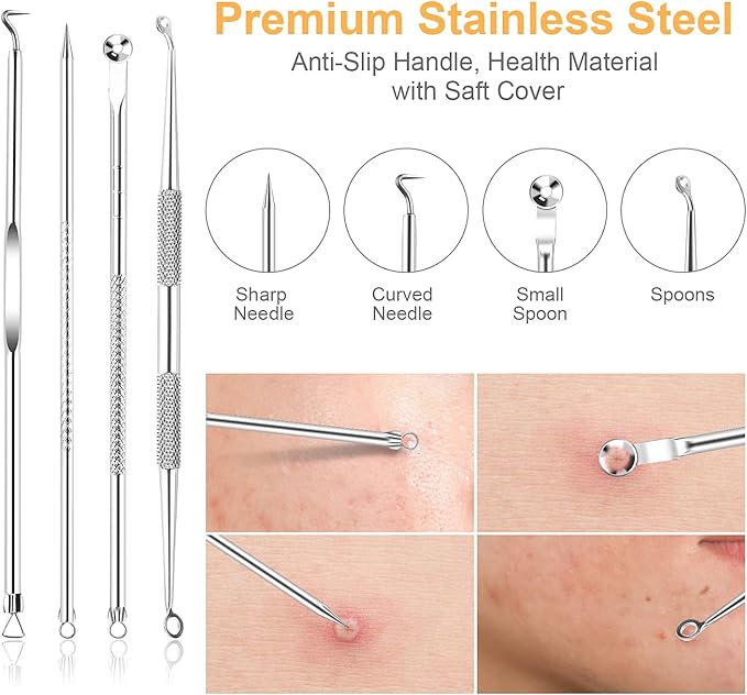Blackhead Remover Tools, 9PCS Pimple Popper Tool Kit - Stainless Steel Pimple/Comedone Extractor & Tweezers for Acne/Zit Removal, Nose & Face Extraction Tools for Estheticians with Leather Case
