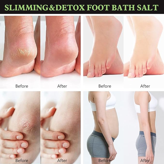 2Pack Herbal Body Detox Foot Soak Salt, Detox & Shaping Cleansing for Men and Women, Daily Rebody Body Detoxingherbs Foot Soak Salt for a Relaxing and Soothing Experience
