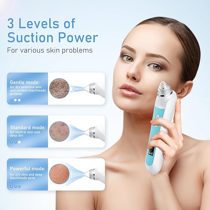 Blackhead Remover Vacuum, USB Interface Type Pore Vacuum, Black Head Extractions Tool with Camera for Men and Women Pore Cleaner, 3 Adjustment Modes & 6 Suction Heads(Blue)