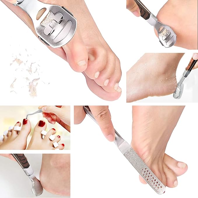Callus Shaver, Foot Shaver Callus Remover for Feet Hand Care with Foot File, 10pcs Blades, Foot File Head and Dead Skin Storage Cover (15Pcs in Total)