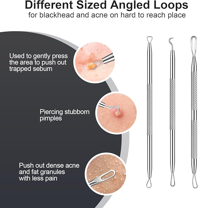 Pimple Popper Tool kit Blackhead Remover Comedone Extractor Kit with Box for Easily Remove blackheads, Acne, Blemishes, Whiteheads, pimples and Papules from the face and Bonus Gift -6pcs