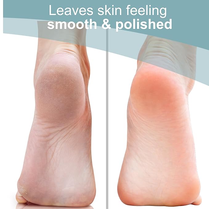 Trim Neat Feet Foot Care Implements Nano Glass Foot File, Hard Skin Remover for Feet, Manual Scraper, Callus Remover, Removes Dead Skin, Smooth Foot Health, Durable Pedicure Tool, Wet Or Dry, 1 Count