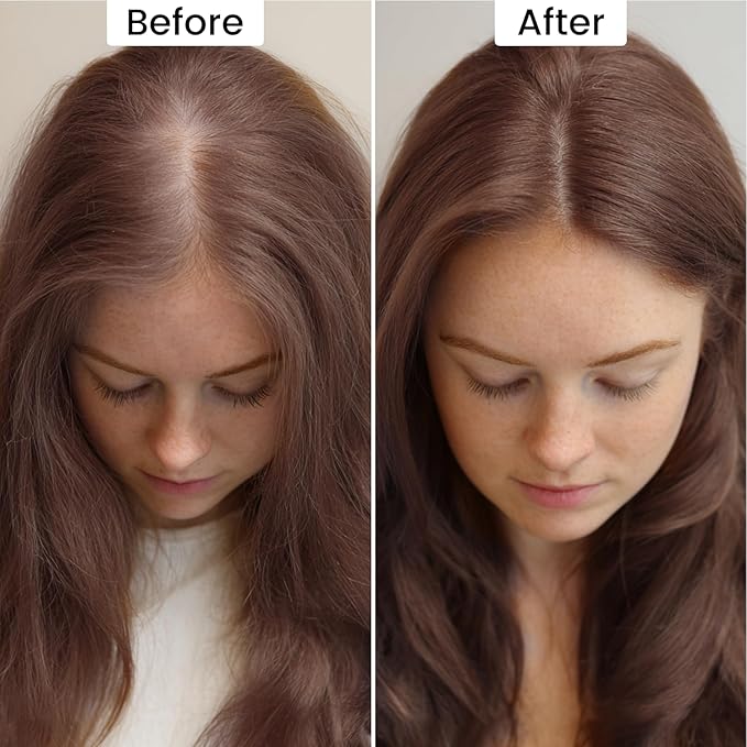 VOLLUCK Root Touch up Powder, Instant Hairline Powder for Thinning Areas and Gray Hair Coverage, Natural and Non-greasy Root Cover up for Women and Men (Hazel Brown, 0.14 Ounce)