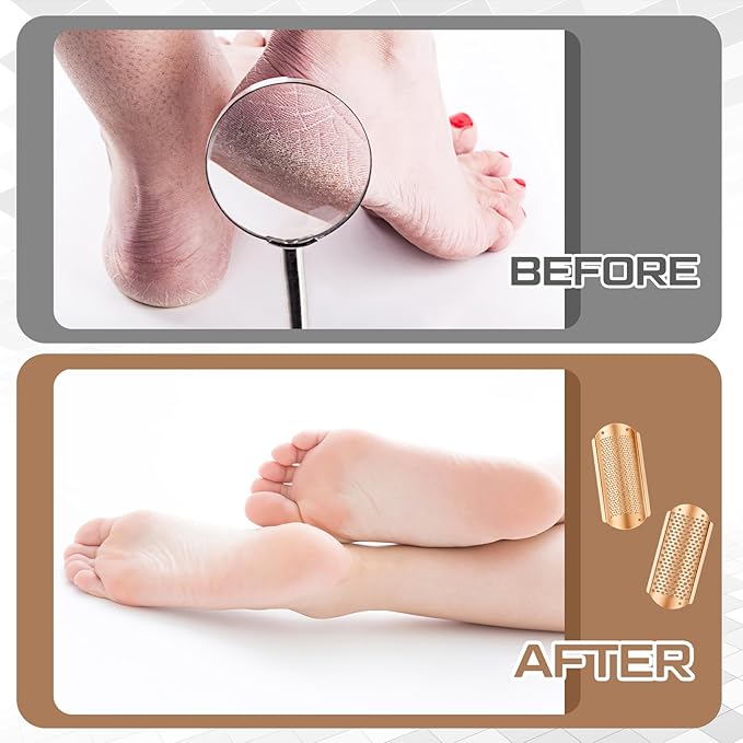 Moxweyeni 8 Pack Rose Gold Foot File Callus Remover Replacement Blades Metal File Callus Remover Hard Skin Remove Stainless Steel 2 Designs Big/fine Hole for Detachable Foot Scrubber