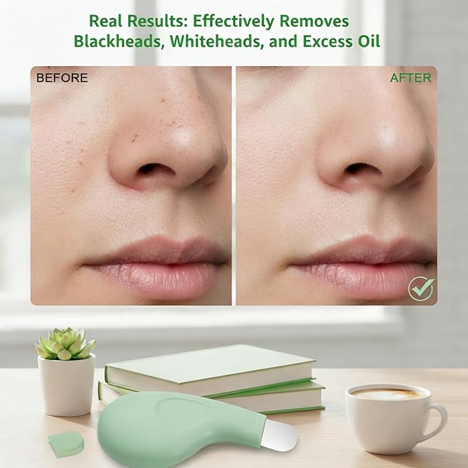Silicone Nose Blackhead Remover, Blackhead Remover Tool, Deep Skin Scrubber Face Spatula, Mild and Safe Face Scraper for Remove Facial and Nose Ehead for Men and Women, Green