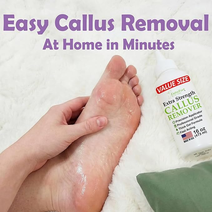 Dr. Entre's 16oz Callus Remover Gel: Extra Strength Value Size, Callus Remover for Feet, Pedicure Tools Supplies, Dead Skin Remover, Foot Care