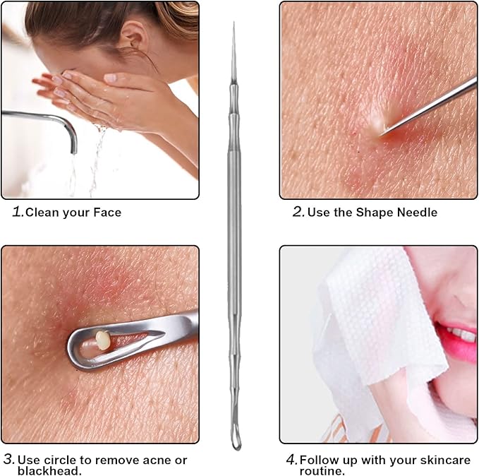 Pointed Blackhead Removal, 2-in-1 Acne Extractor Tool - Stainless Steel Whitehead Remover for Face/Nose