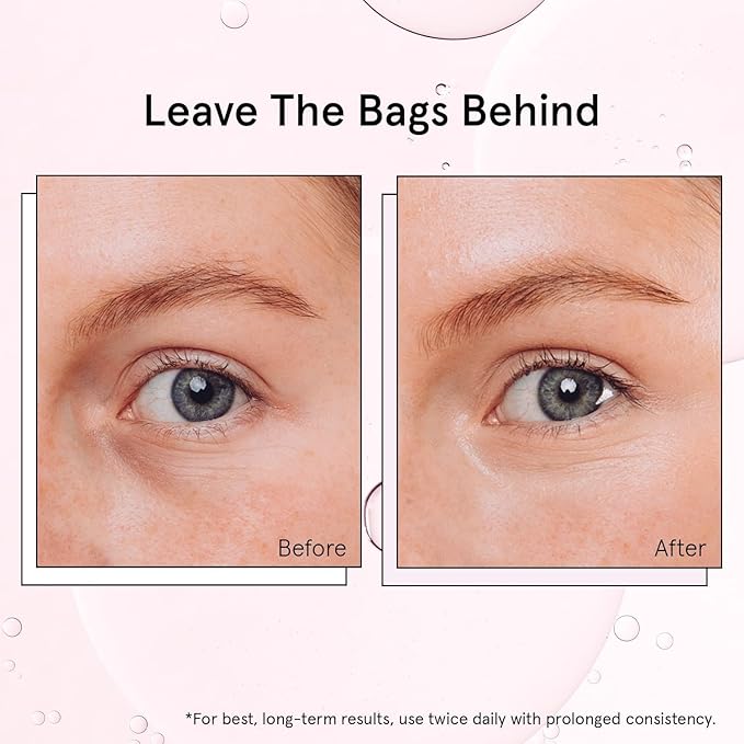grace & stella Under Eye Brightener Roller - Airplane Travel Essentials - Travel Size Toiletries - Retinol & Caffeine Eye Serum for Puffiness, Dark Circles, Wrinkles - Vegan Skincare (15ml / 0.51floz)