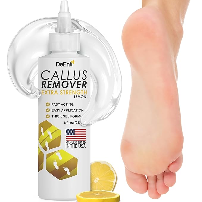 DeEnti Callus Remover for Feet, Extra Strength Foot Callus Remover Gel, 8oz Salon Grade Home Pedicure Supplies for Dry Skin, Cracked Heel, Professional Strength Foot Care, Lemon