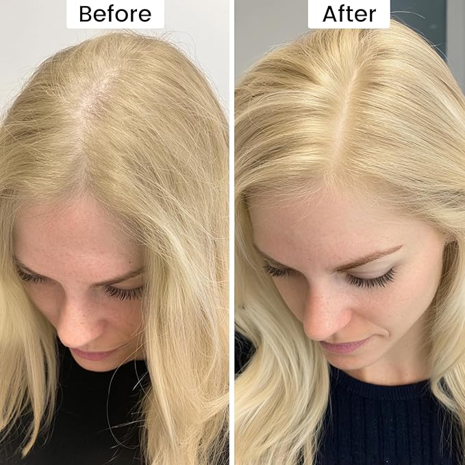 VOLLUCK Root Touch up Powder, Instant Hairline Powder for Thinning Areas and Gray Hair Coverage, Natural and Non-greasy Root Cover up for Women and Men (Light Blonde, 0.14 Ounce)