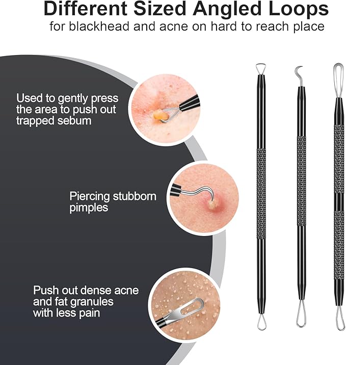 Pimple Popper Tool kit Blackhead Remover Comedone Extractor Kit with Box for Easily Remove blackheads, Acne, Blemishes, Whiteheads, pimples and Papules from the face and Bonus Gift -6pcs