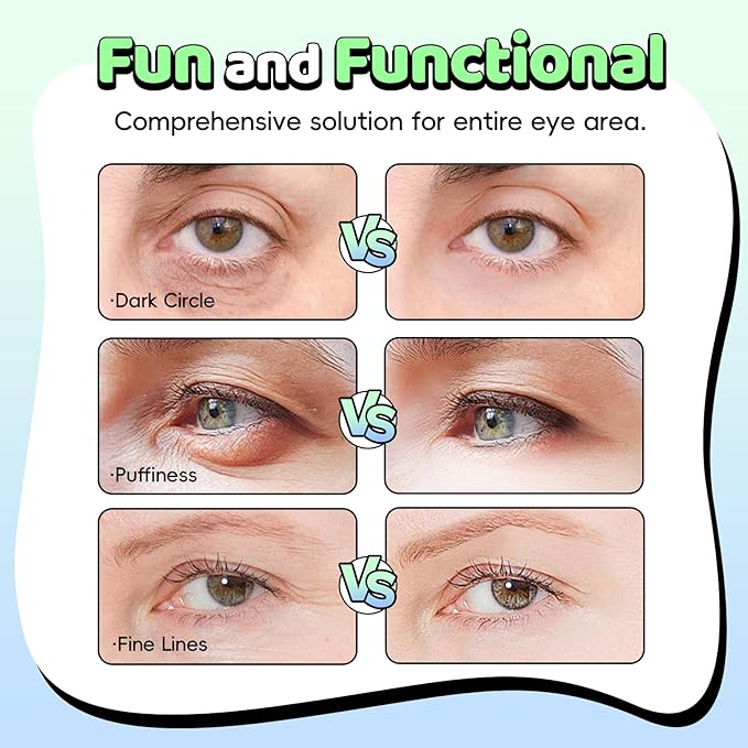 NEWGO Gel Ice Pack for Eyes, Reusable Cooling Eyes Patches with Funny Design, 4 Pairs Soft Cold Compress Therapy Eye Pads for Puffiness, Dark Circles, Migraines, Allergies, Fits All Eye Shapes