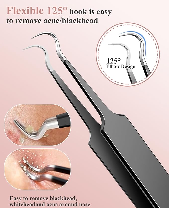 3PCS Pimple Extractor Acne Treatment Tool Professional Stainless Blackhead Comedone Removal Popper Tool for Face Nose Blackhead Extractor Tool (Black)