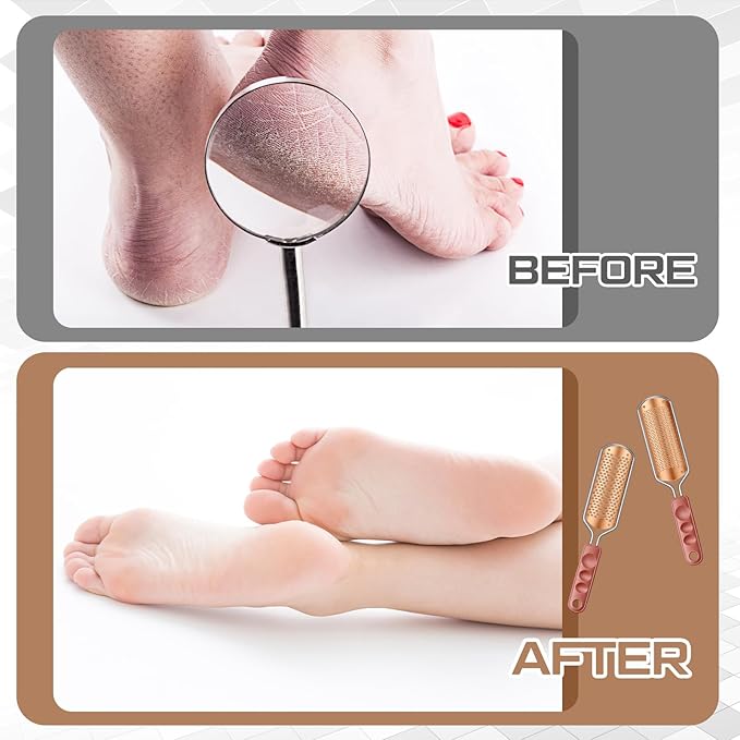 Moxweyeni 14 Pack Colossal Foot File Pedicure Tool Set with 2 Style Large and Small Hole Replacement Callus Remover Blades Rose Gold Stainless Steel Detachable Pedicure Foot Rasp for Dead Skin Remover