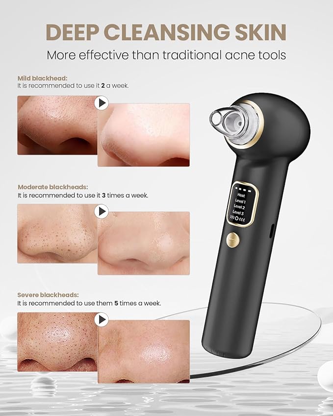 Electric Blackhead Remover Vacuum with Heating, 3 Suction Levels 5 Probes Pore Extractor Kit, Rechargeable Deep Pore Cleansing Tool for Women & Men (Black)