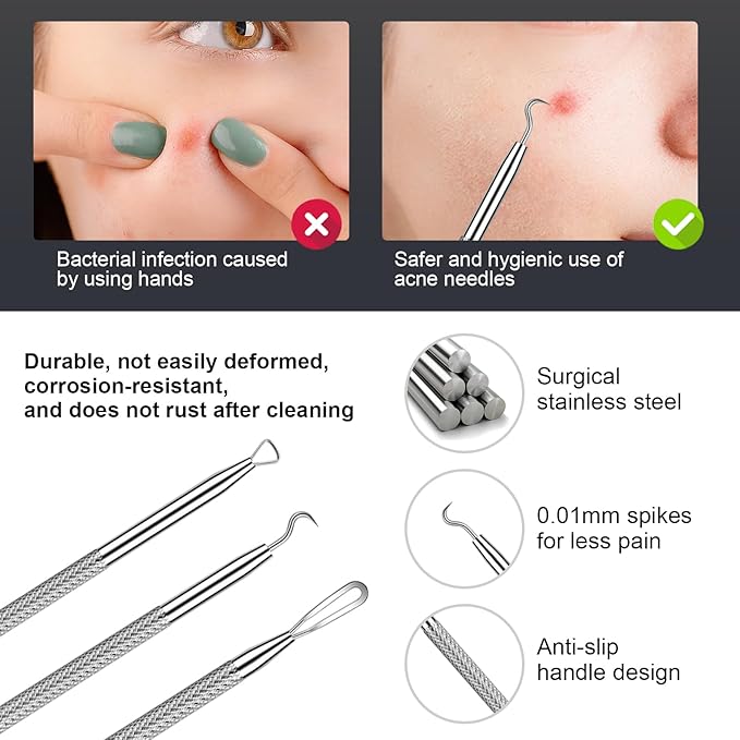 Pimple Popper Tool kit Blackhead Remover Comedone Extractor Kit with Box for Easily Remove blackheads, Acne, Blemishes, Whiteheads, pimples and Papules from the face and Bonus Gift -6pcs