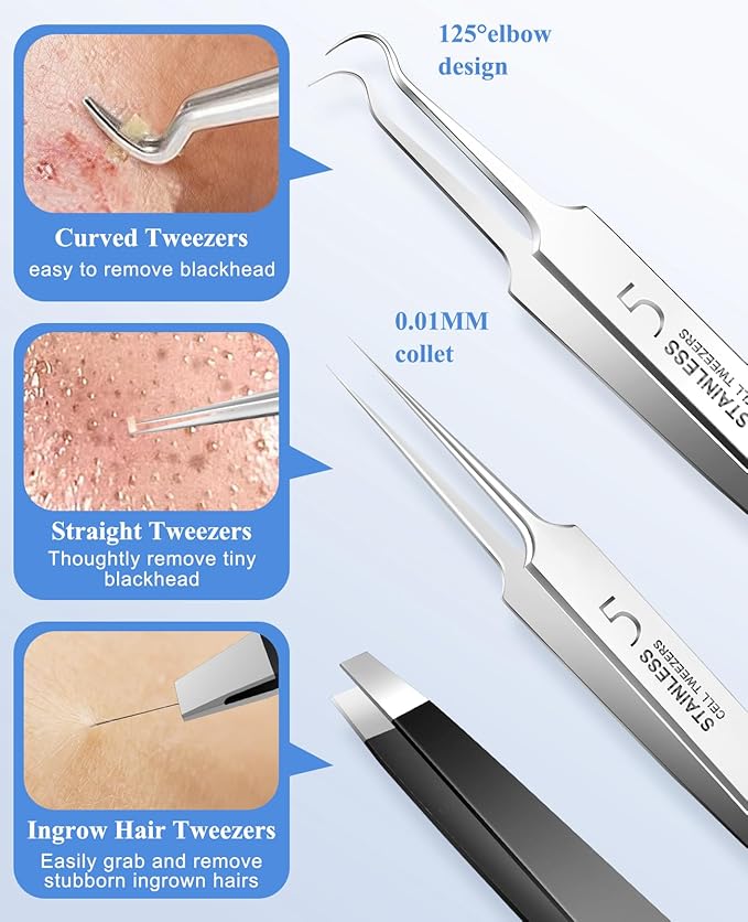 3PCS Blackhead Remover Tweezers, Pimple Popper Tool Kit with 2 Blackhead Extractor and 1 Ingrown Black Hair Tweezers for Blemish, Whitehead Popping,Facial Hair