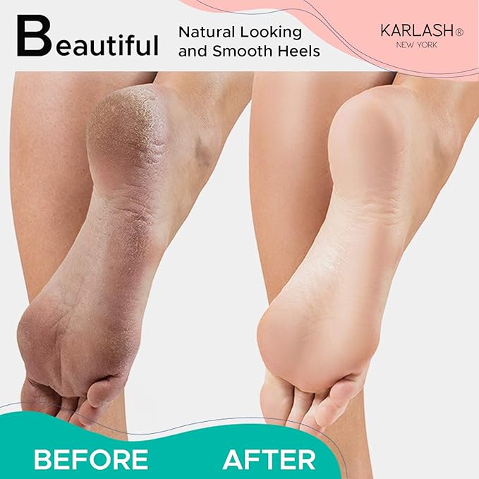 Karlash 2-Sided Nickel Foot File for Callus Trimming and Callus Removal, Mint (Pack of 2)