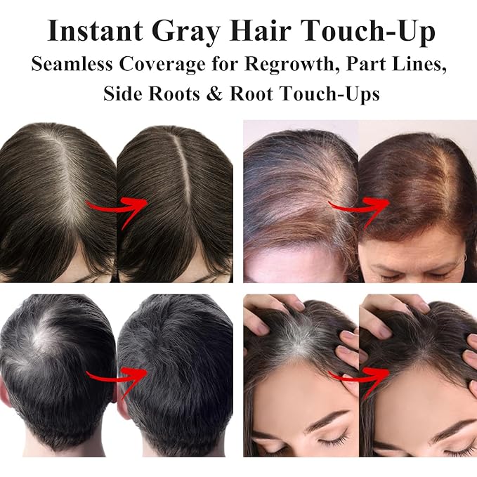 VOLLUCK Root Touch up Powder, Long-lasting Gray Hair Cover up Powder for All Hair Types, Waterproof for Women and Men (Medium-Brown, 0.42 0unce)
