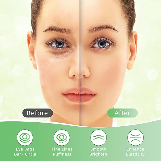 Under Eye Patches, 40 Pairs Eye Mask for Dark Circles, Puffy Eyes, Undereye Bags,Wrinkles,Eye Mask Patches with Aloe Vera, Eye Treatment Skin Care for Men & Women Gift