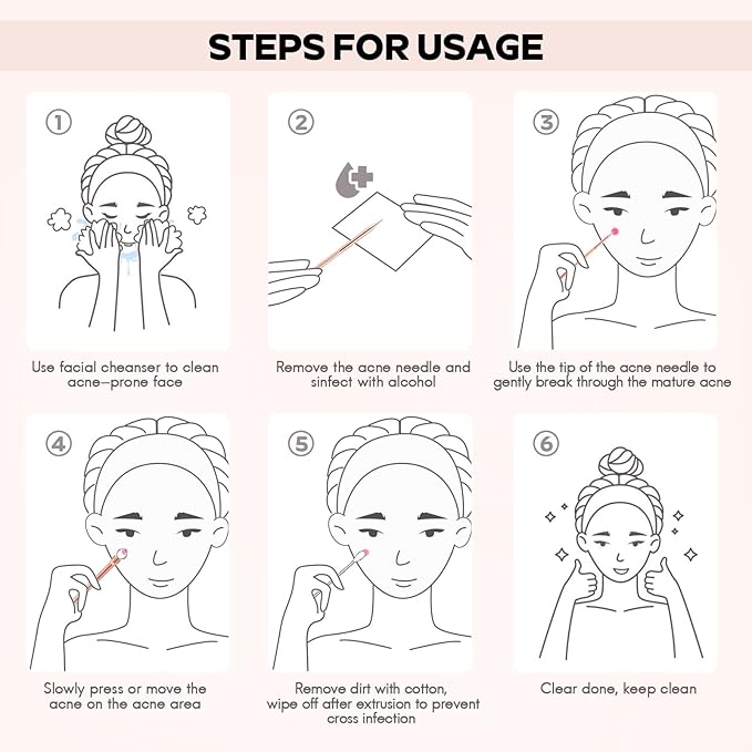 FEITA Blackhead Remover Pimple Comedone Extractor Tool, Stainless Acne Tools Pimple Popper Removal Kit, Zit Whitehead Popping Needle for Nose & Face, Rose Gold 4Pcs