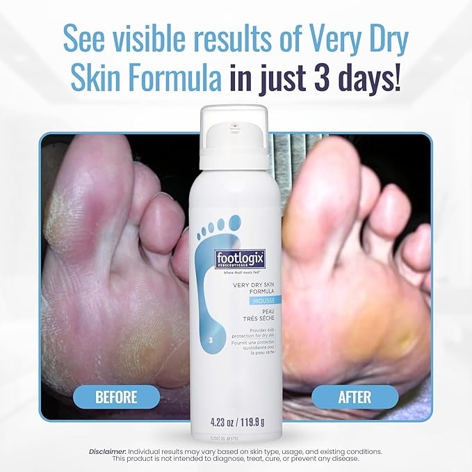 Footlogix #03 Very Dry Skin Formula
