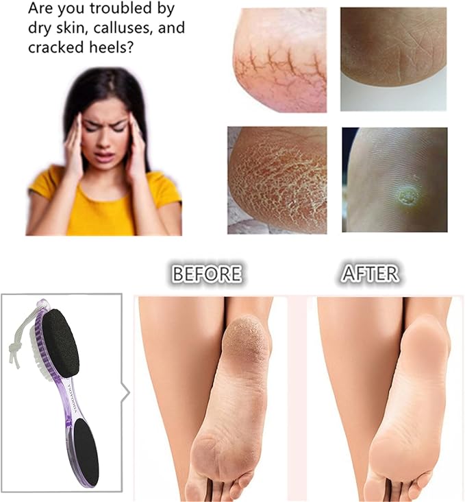 Foot File Callus Remover 4-in-1, Feet Scraper Pedicure Tools with Pumice Stone, Scrubber Brush, Foot Rasp and Sand Paper, Double Sided Multi Purpose, Clear Black and Purple